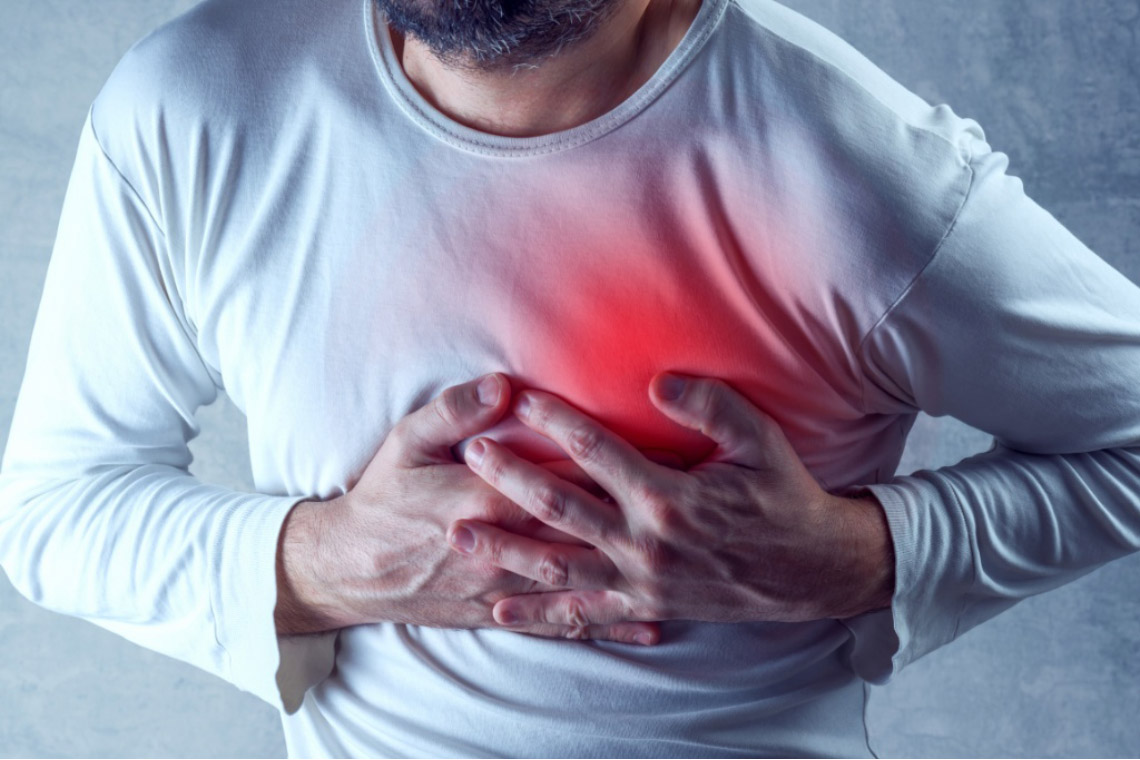 Angina Pectoris